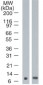 S100A7 / Psoriasin Antibody (clone 47C1068)