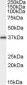 ARA9 / AIP Antibody (C-Terminus)