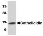 LL37 / Cathelicidin Antibody (C-Terminus)