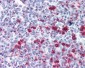 CD20 Antibody (clone MEM-269)
