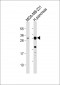 PRSS3 Antibody (Center)