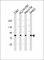 MLXIPL Antibody (C-term)