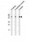 DMRT2 Antibody (Center)