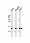 NDUFB3 Antibody (N-Term)