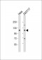 CDK11B Antibody