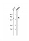 DOK1 Antibody