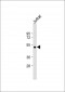 SH2D2A Antibody