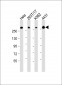 FLNB Antibody (N-Term)