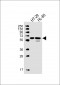 MMP25 Antibody (C-term)