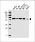 DBNL Antibody (C-term)