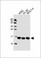 RPLP2 Antibody (N-Term)