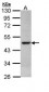 CS / Citrate Synthase Antibody (Internal)