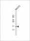 CDKN2C Antibody (C-term)