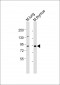 Parp9 Antibody (C-term)