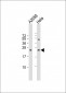 SDHD Antibody (N-term)