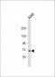 RNF43 Antibody (C-term)