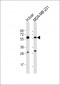 UGT2B4 Antibody(N-term)