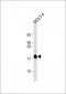AP2118b-UBE2L6-Antibody-C-term