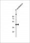 GAS7 Antibody (C-term)