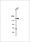 PHLPP1 Antibody (N-term)