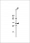 RPH3AL Antibody (C-term)