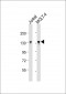 BCL11B Antibody (Center)