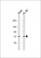 VWA2 Antibody (N-term)