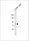 ADAM11 Antibody (N-term)