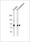 Mouse Prkcg Antibody (N-term)