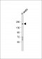 DLEC1 Antibody (Center)