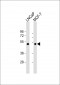 TXNIP Antibody(N-term)