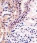 PHC3 Antibody (C-Term)