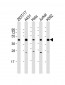 PHF6 Antibody (C-Term)