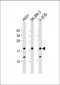 THRSP Antibody (N-Term)