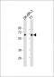 SLC5A8 Antibody (C-Term)