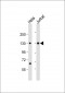 MTUS1 Antibody (C-Term)