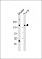 MTUS1 Antibody (N-Term)