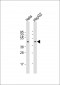 CERS2 Antibody (Center)