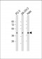 ST3GAL4 Antibody (N-Term)