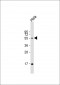 FUT6 Antibody (Center)