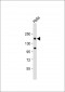 CLTC Antibody (Center)