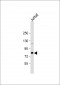 ALKBH8 Antibody (C-term)