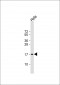 PTP4A2 Antibody (Center)