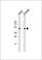 STYK1 Antibody (N-term)