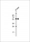 AP8514c-SLC11A1-Antibody-Center