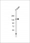 ADCY8 Antibody (Center)