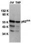 DOK1 Antibody