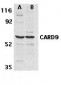 CARD9 Antibody