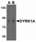 Cathelicidin Antibody