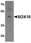 SOX18 Antibody